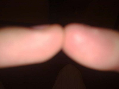 300720111961.jpg (14.15 KiB) Vist 2744 gange Mine to ringe fingre mod hinanden. Det var det bedste min tlf kunne klare når jeg selv skulle tage det:-)